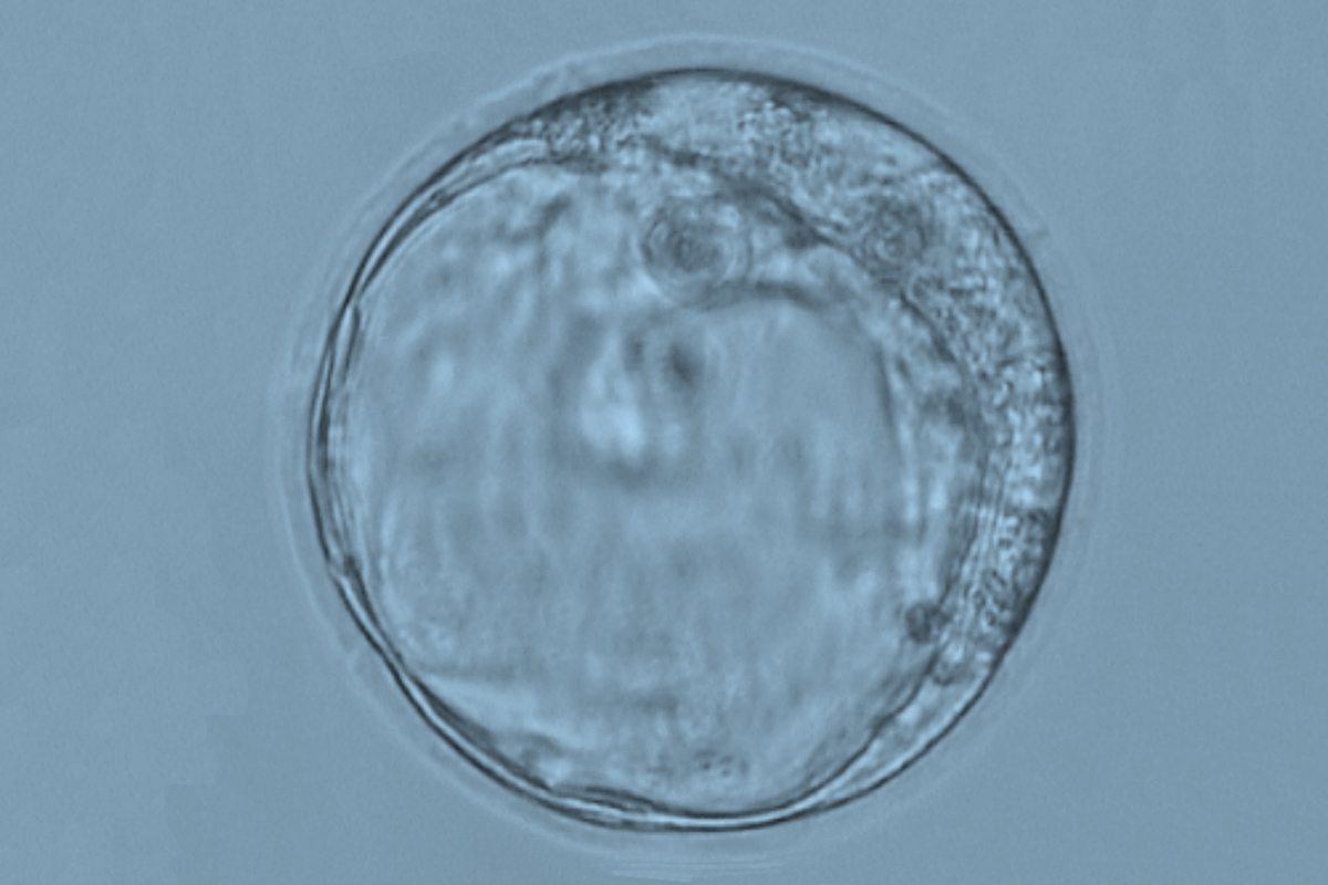 An embryo is about to be tested